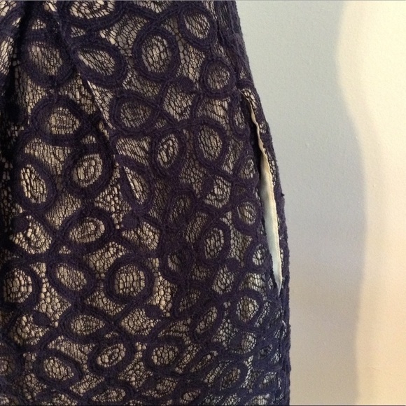 MISS SIXTY DRESS WITH POCKETS ✨✨✨ - Picture 3 of 3